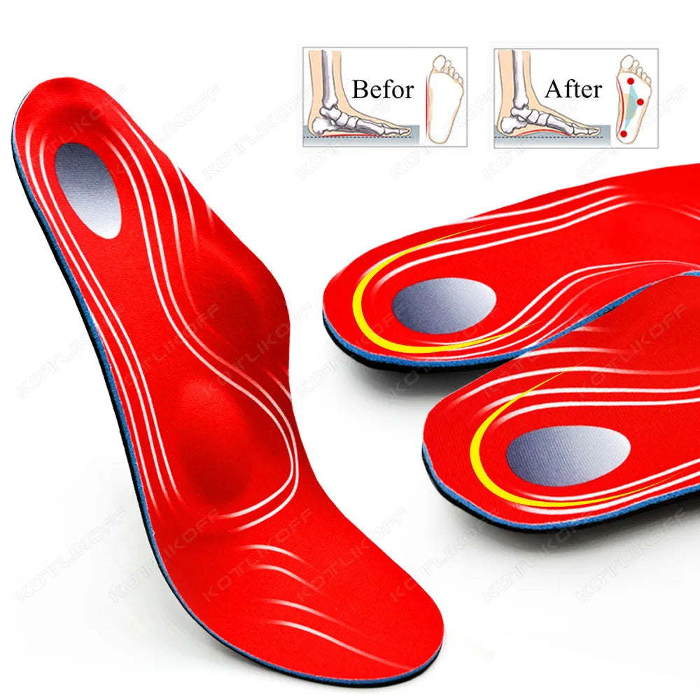 Severe Flat Feet Insoles Orthotic Arch Support